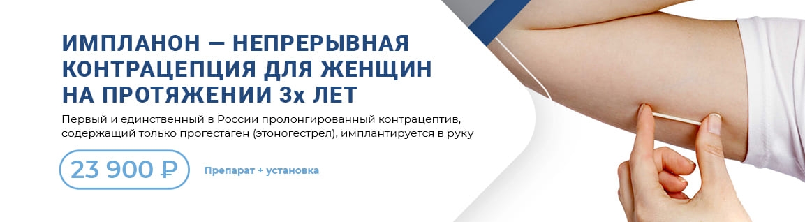 Установка контрацептива Импланон® = 23900 рублей